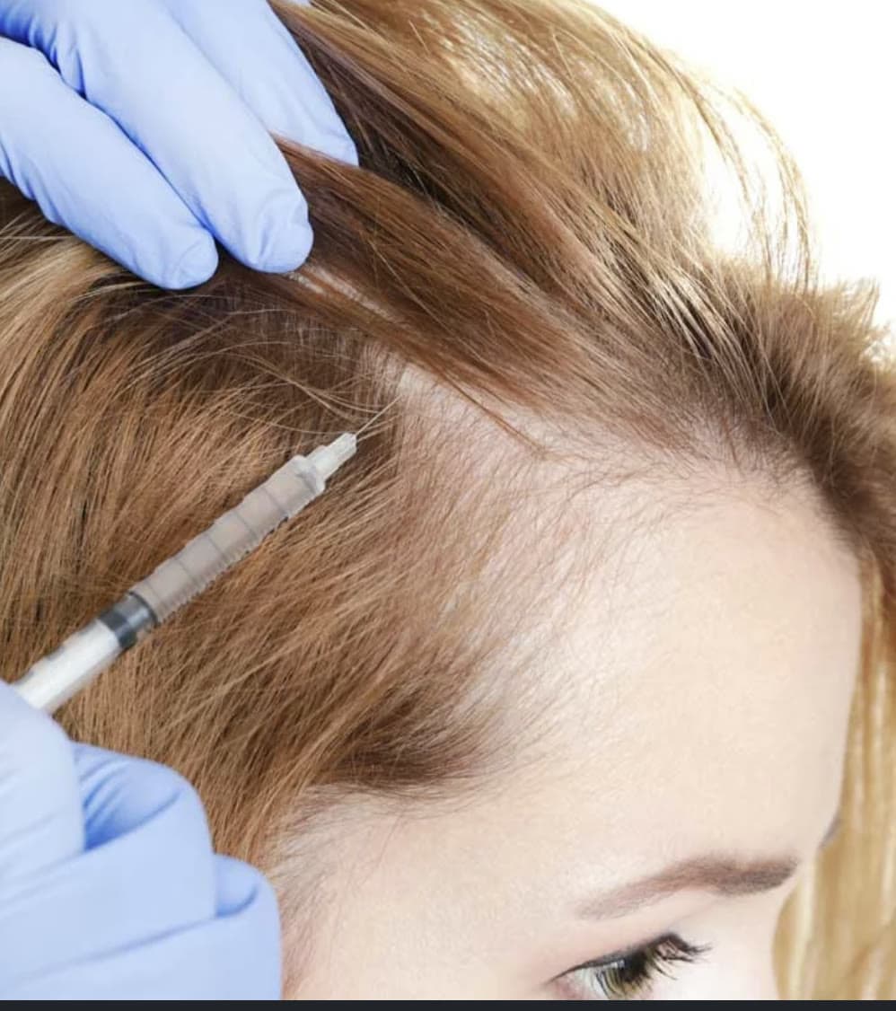 Clinical photograph showing alopecia areata