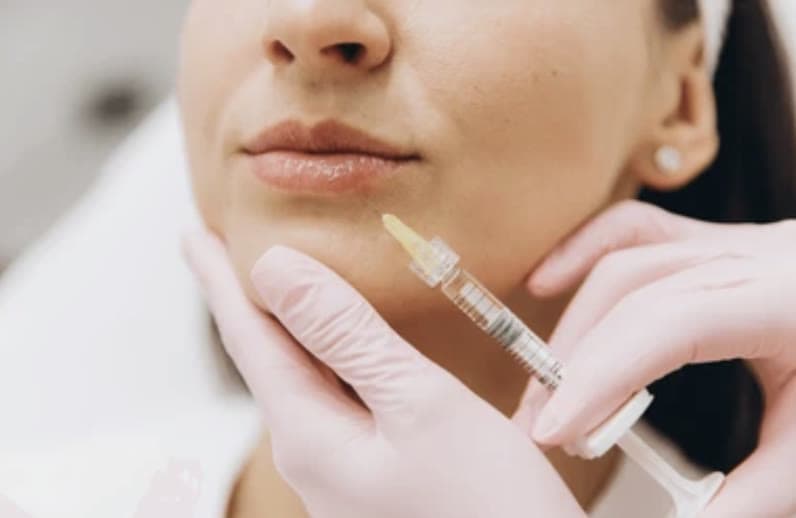 Clinical photograph showing botox