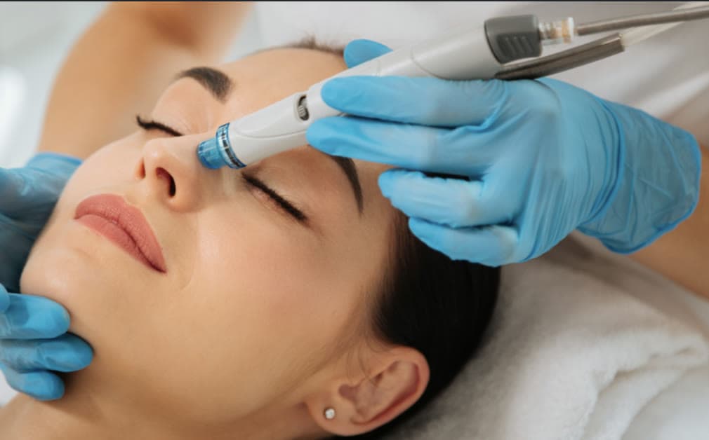 Clinical photograph showing hydrafacial