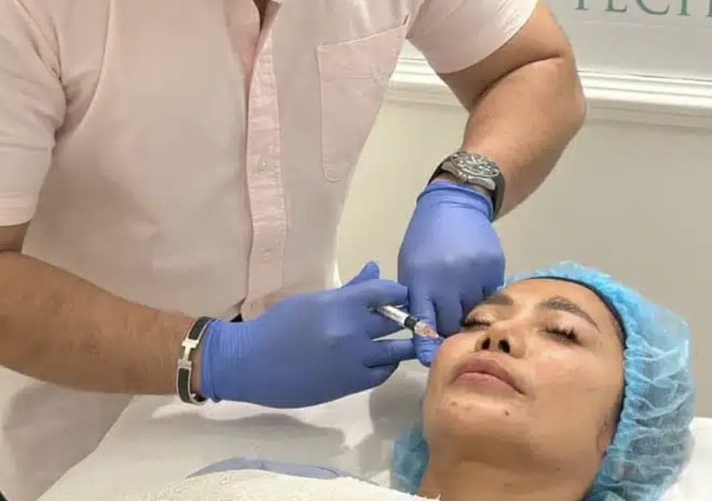 Clinical photograph showing prp for skin