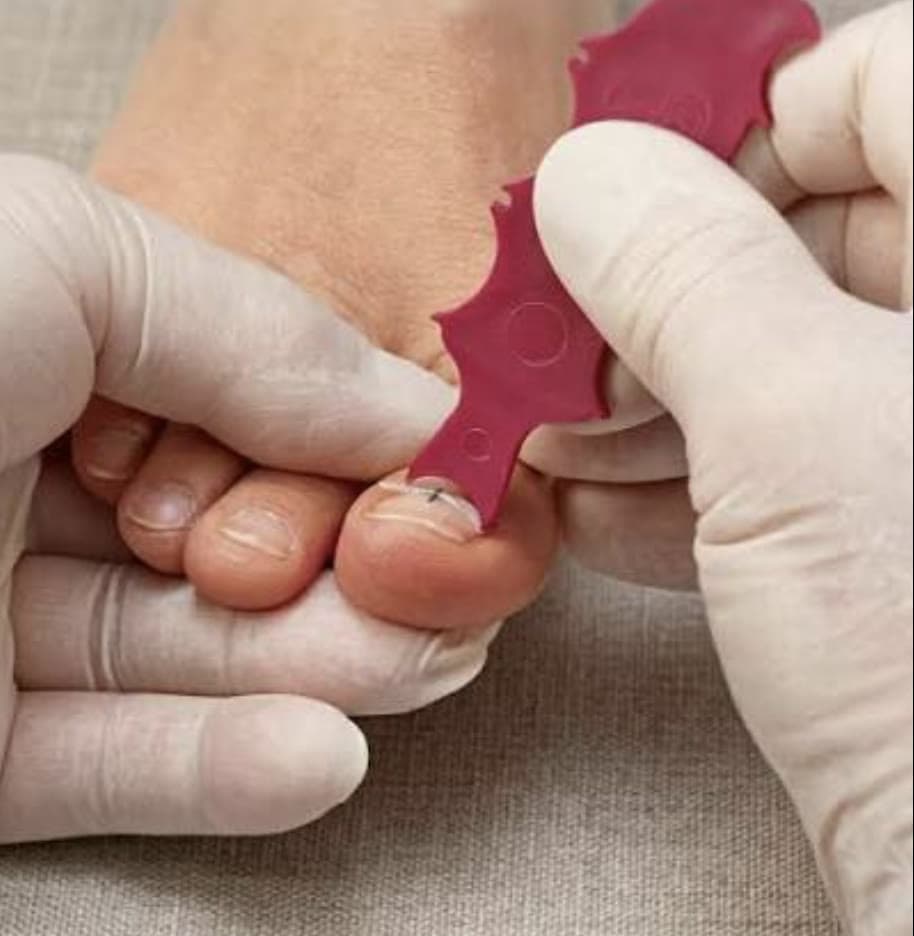 Clinical photograph showing nail disorders