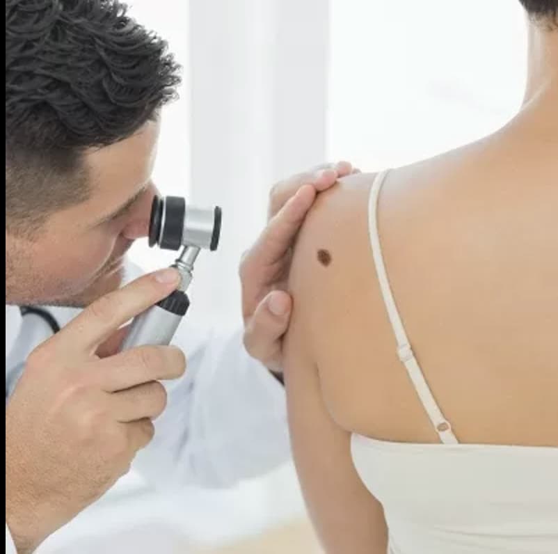 Clinical photograph showing skin cancer screening