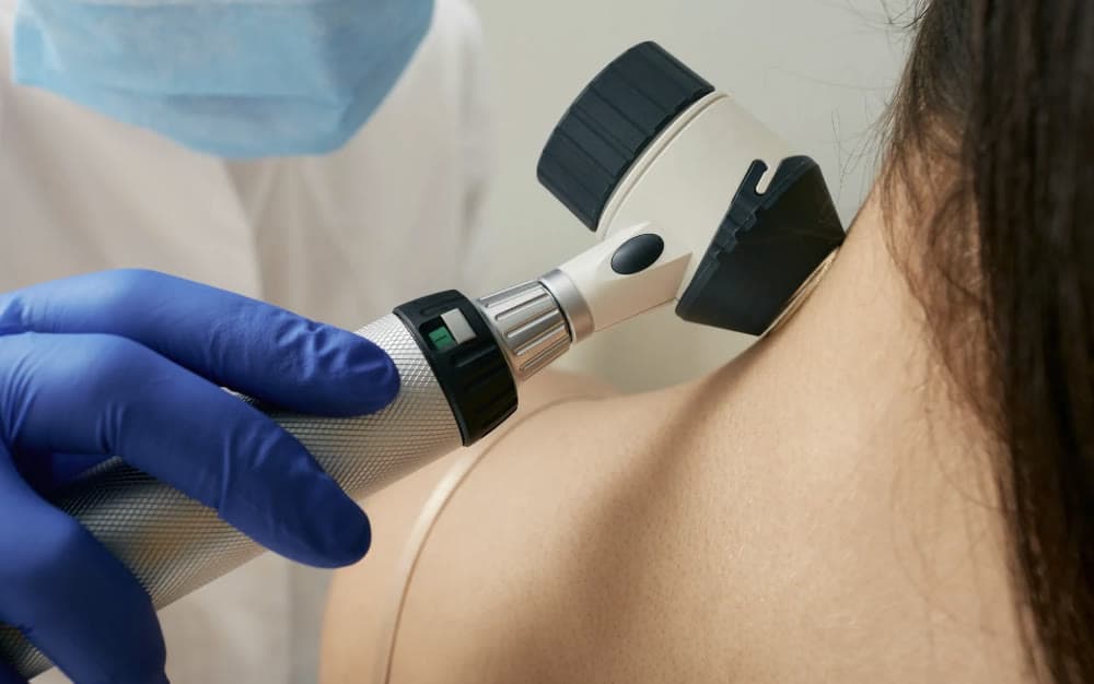 Clinical photograph showing skin tag removal