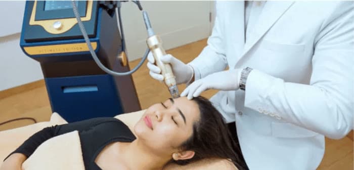 Clinical photograph showing sylfirm x